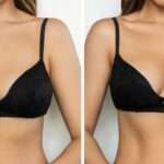 cropped-shot-young-tanned-woman-bra-before-after-breast-augmentation-with-silicone-implant-min-1024x499-1-150x150
